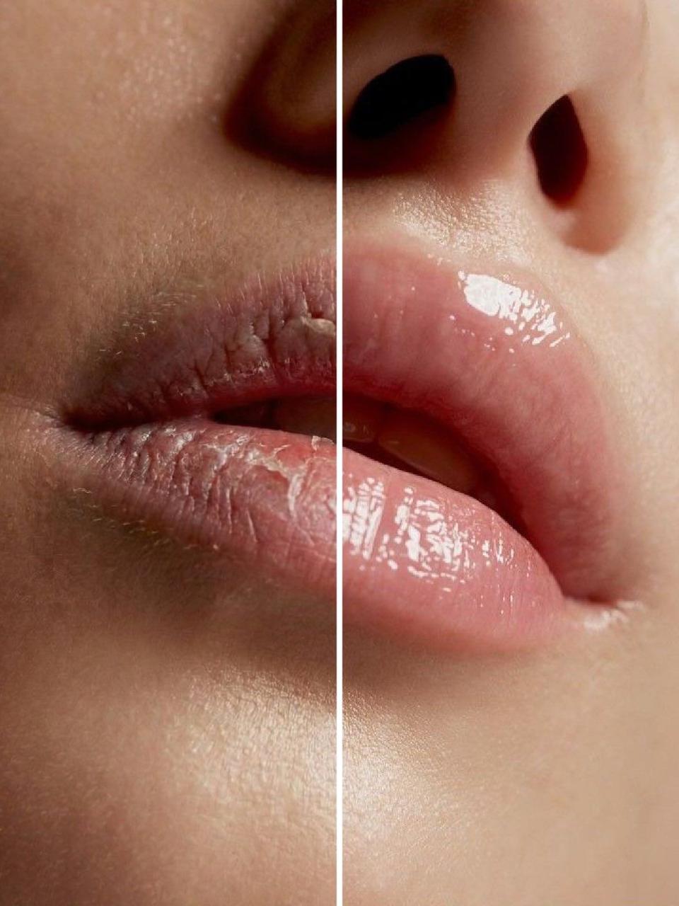 Hidralips hidratación de labios Medellín — MV Brow Studio